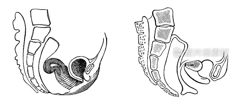 人体子宫轴的医学插图，弯曲和版本- 19世纪